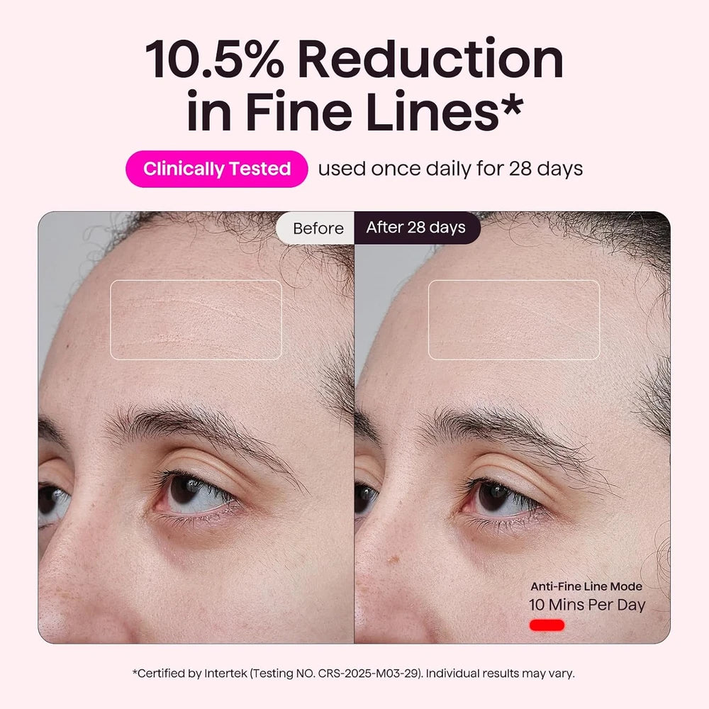 wavytalk Red Light Therapy Mask – LED Face Mask for Anti-Aging & Glowing Skin