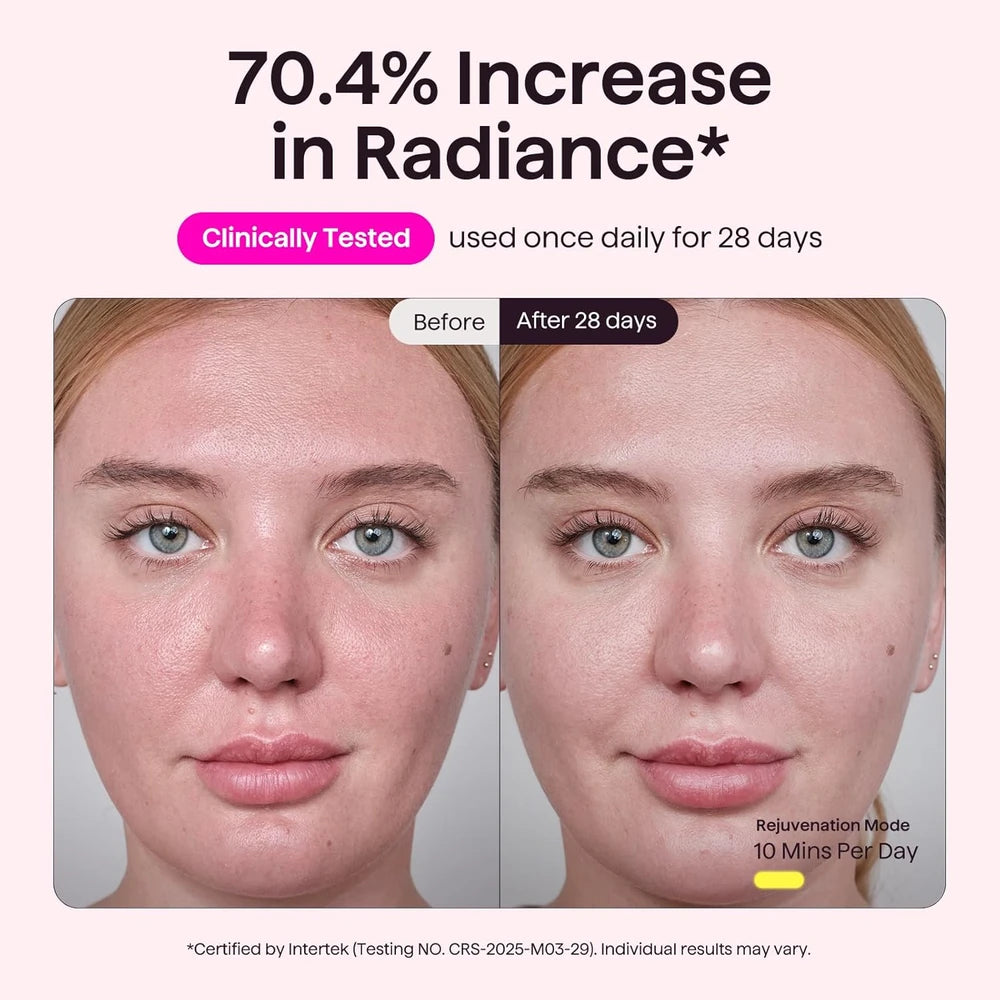 wavytalk Red Light Therapy Mask – LED Face Mask for Anti-Aging & Glowing Skin